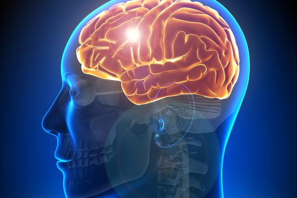 Stroke Neurological
